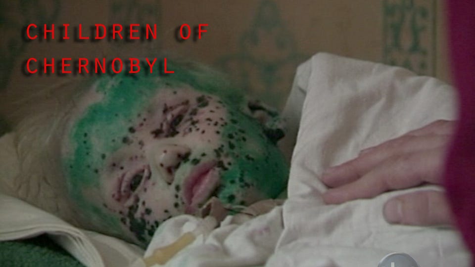 The true story and the real pain of Chernobyl children | by Nicole FC |  Responding to Disaster | Medium