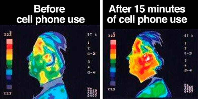 adderall good effects of radiation