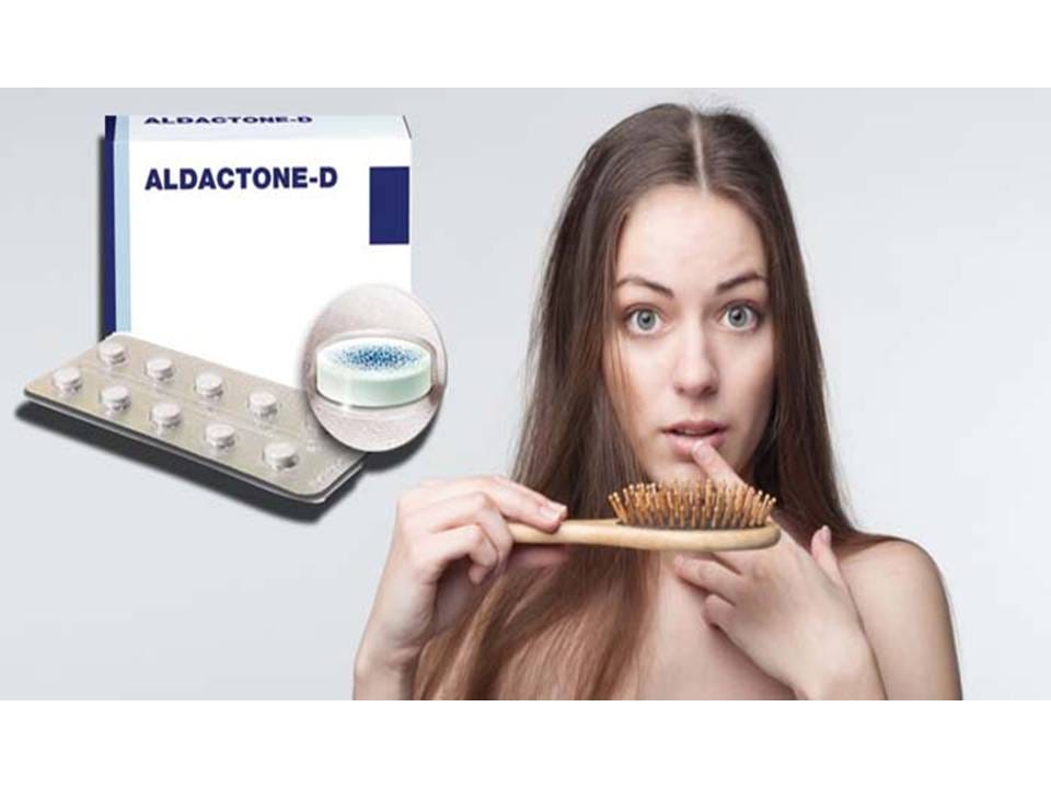 Aldactone And Minoxidil For Hair Loss Misty Awery Medium