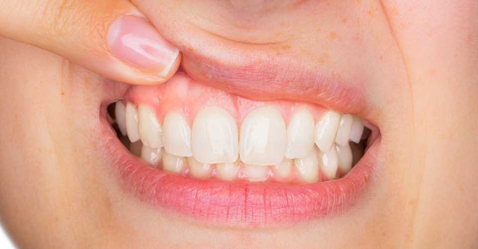 Lindaa Natural Regrowth Best The ... Gum Products 2019 - Raynor Raynor - Lindaa Gum Best Natural Products 2019 Regrowth The ...