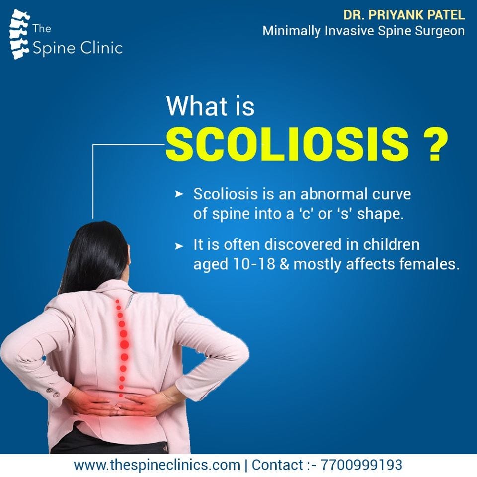 WHAT IS SCOLIOSIS | by The Spine Clinics | Medium