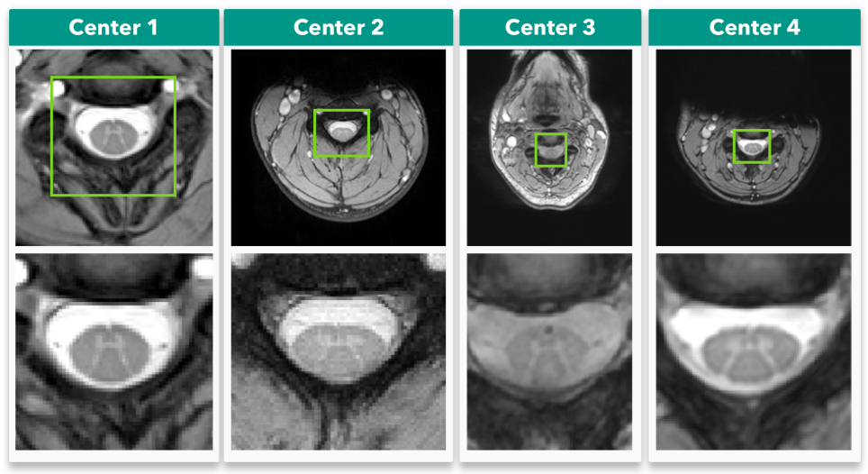 Medical Imaging Analysis using PyTorch by elvis DAIR.AI Medium