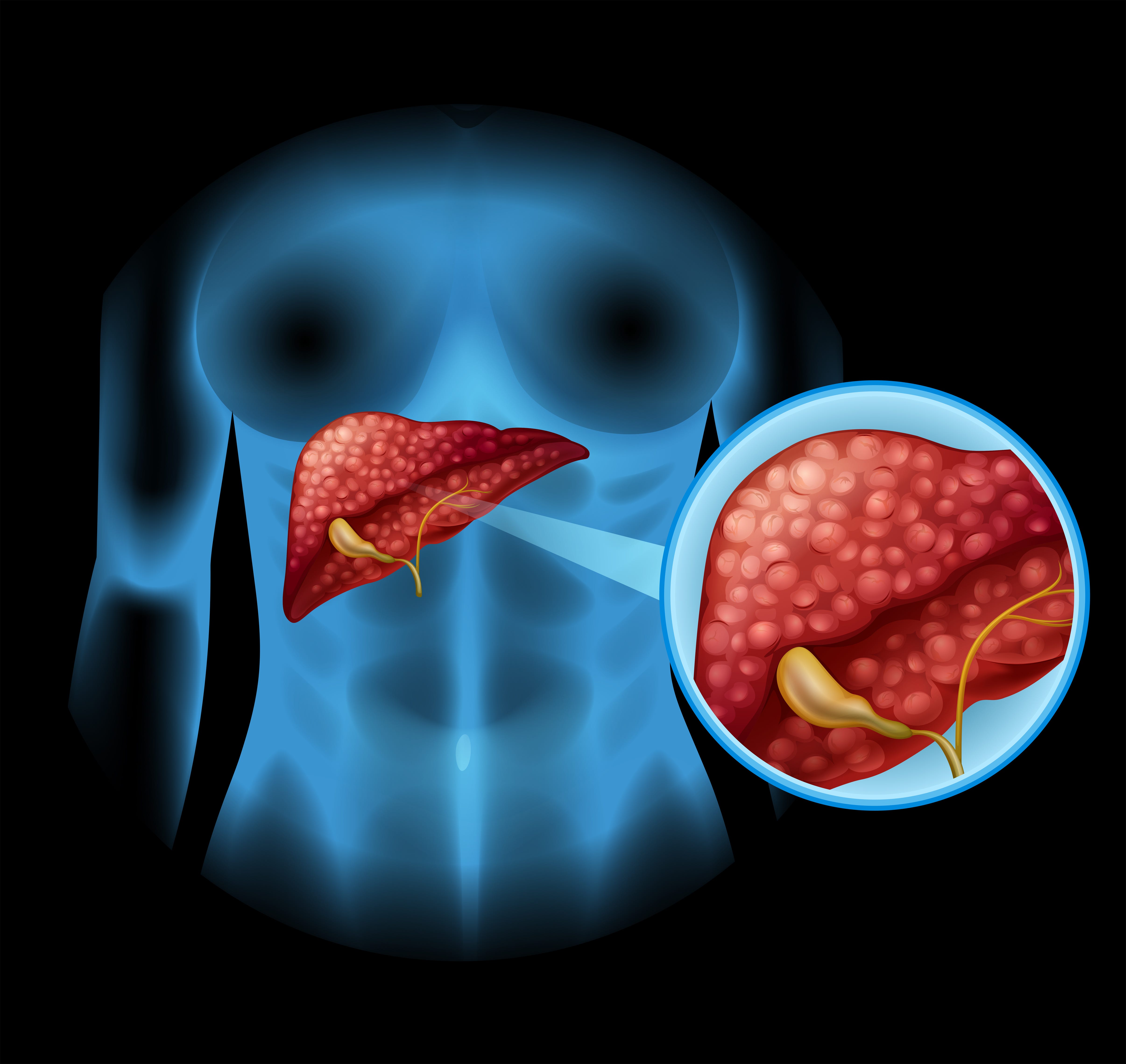 Quanto Ci Mette Il Fegato A Disintossicarsi Dall Alcol