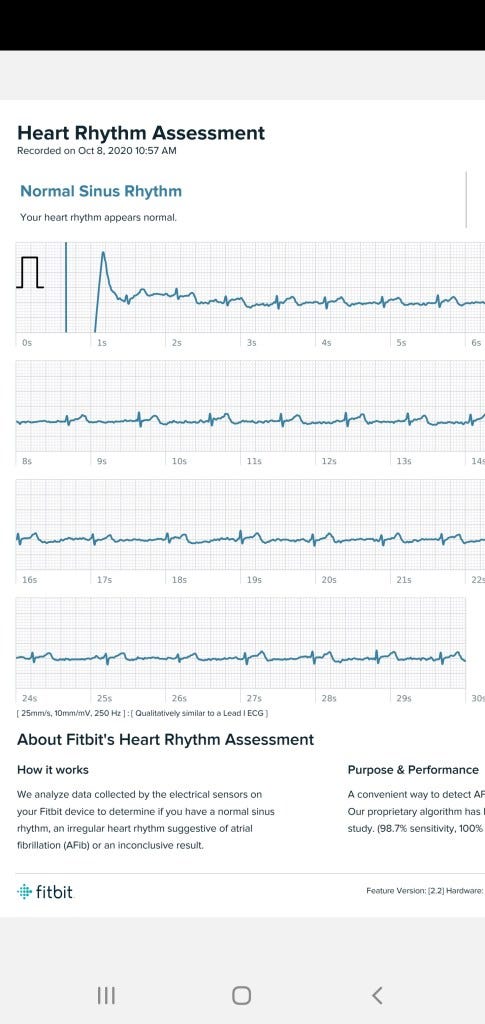 How to Use the ECG App On Your Fitbit Sense | by Thomas Smith | DIY Life  Tech