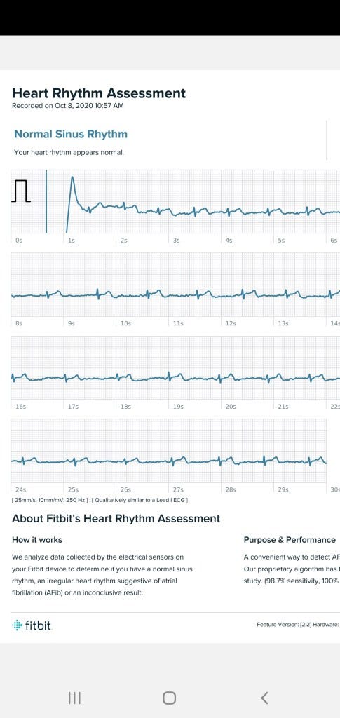 fit bit sense ecg