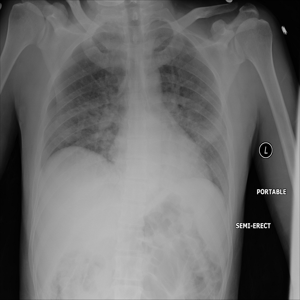 What are radiological deep learning models actually learning?