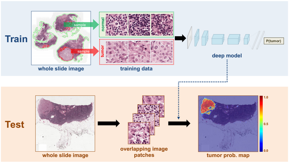 Understanding Cancer using Machine Learning - Towards Data ... gene vs dna vs rna diagram 