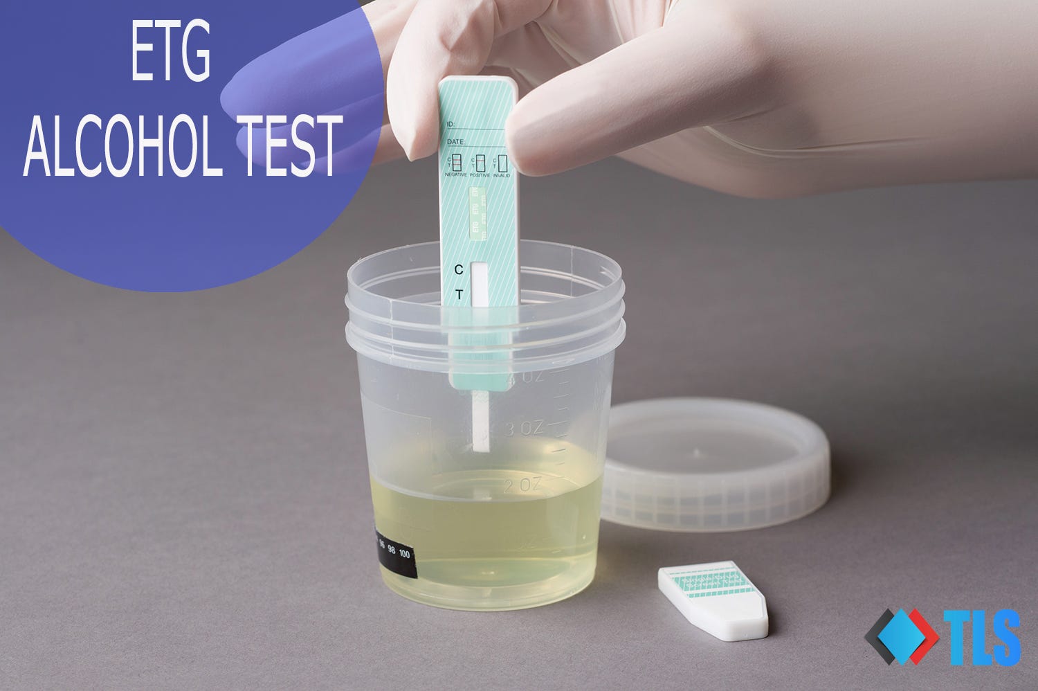 All You Need To Know About EtG Alcohol Test | by Sanjeev Kumar | Medium