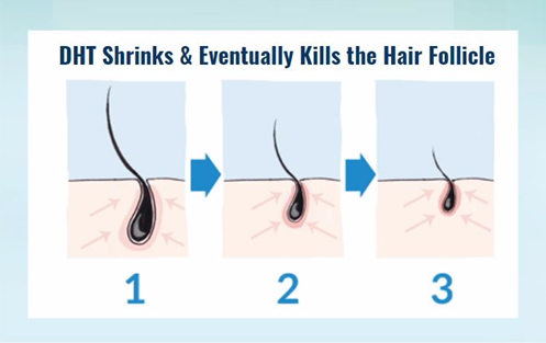 How To Regrow Hairline Naturally Donna Jenkins Medium