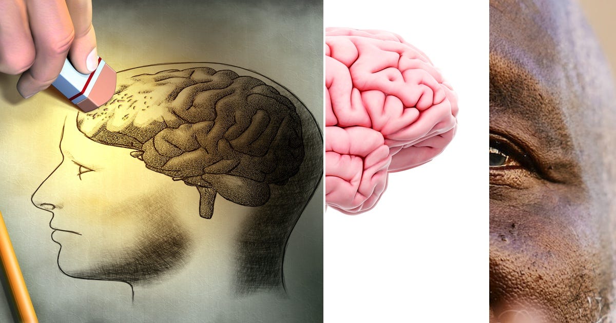 List: Brain | Curated by Pfeiner | Medium