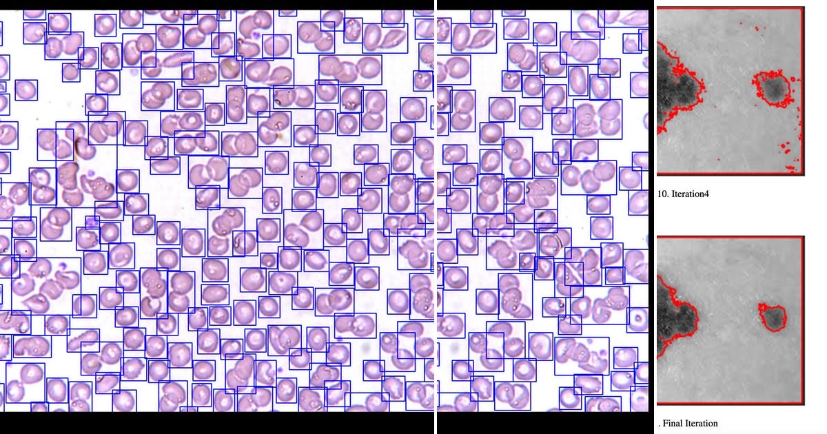 List Computer Vision Curated By Imadoissaf Medium List computer vision curated by imadoissaf medium