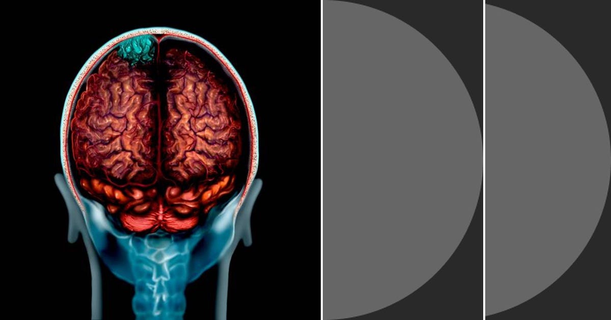 List Neurosurgery Curated by Mark Crabtree Medium