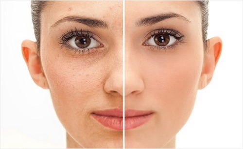 Best Facial Exercises For Wrinkles You Can Follow by Ridaul Arfiyanti Medium