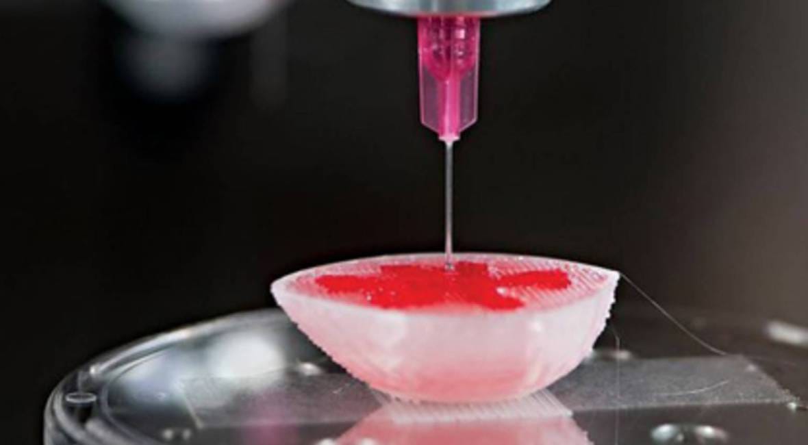 The Feasibility of 3D Bioprinting, by Shadab Hassan
