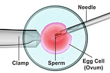 Let’s Talk About ICSI (Intracytoplasmic Sperm Injection)