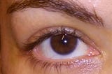 Make Your Eyes More Beautiful With Laser