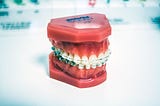The HR Smile banner image showing teeth in braces (TLTW; Samuel Edward Koranteng)