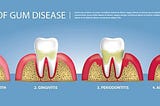 How Do I Kill Gum Disease?