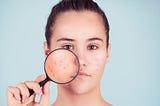 Acne and Blackhead Treatments and Prevention