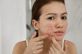 The Best Creams for Pimples: Say Goodbye to Acne Troubles