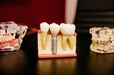 What Wisdom Tooth Extraction Taught Me About Wisdom