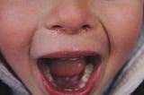 A child with snot coming out of the nose and mouth hanging wide open