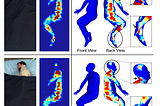 BodyMAP: A Game Changer for Pressure Injury Prevention in Healthcare