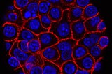 Increasing Natural Killer Cell Potency in Pancreatic Cancer