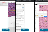 Pathology Image Labeling Comes to MONAI