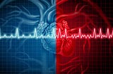 Ablation Treatment for Atrial fibrillation