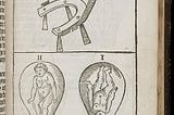 Comparing Birthing Positions: Supine or Squat