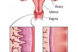 An Overview of Vaginal Dryness: What Are its Causes, Symptoms, Risk Factors, and How to Minimize It?