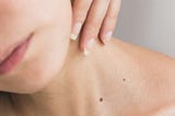 How to Avoid Skin Cancer: Simple Steps for Sun Safety