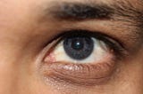 Get all the right data on Laser Eye Color Change Surgery