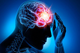 Brain Injuries Effective in Civil Suits for Punitive Damages and Negligence