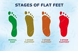 Mastering Flat Feet Management: Your Ultimate Guide to Orthotic Insoles and Lifestyle Adjustments