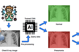 Pneumonia Diagnosis Using Deep Learning Techniques