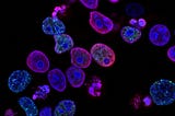 CRISPR and allogenic CAR-T Cells is revolutionary for cancer treatments