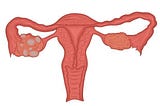 Visualizing posts and conversations around PCOS