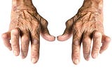 Understanding Rheumatoid Arthritis: A Comprehensive Guide to Managing Joint Health