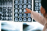 The Role of Sirtuins in Aging and Neurodegenerative Diseases
