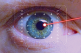 A Breakthrough in LASIK Eye Surgery