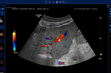 How PACS, RIS, and DICOM Work Together in Modern Medical Imaging