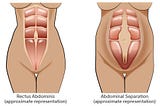 The Ultimate Mother’s Guide to Diastasis Recti Resources; Healing Abdominal Separation Postpartum