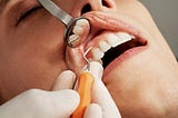 Heart burn can cause gum disease, look how a man prevent and cure Gingivitis