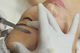 Causes of facial hair and why Dermaplaning offers an ideal solution to facial hair management