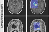 A scan of a skull getting analyzed by AI