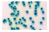 Cronobacter in infants formula