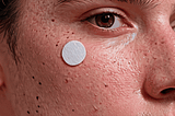 Acne-Patches-1