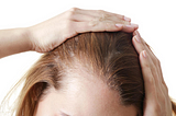 How To Select The Right Hair Topper